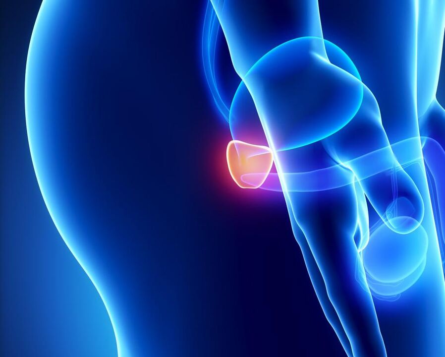 Prostatitis